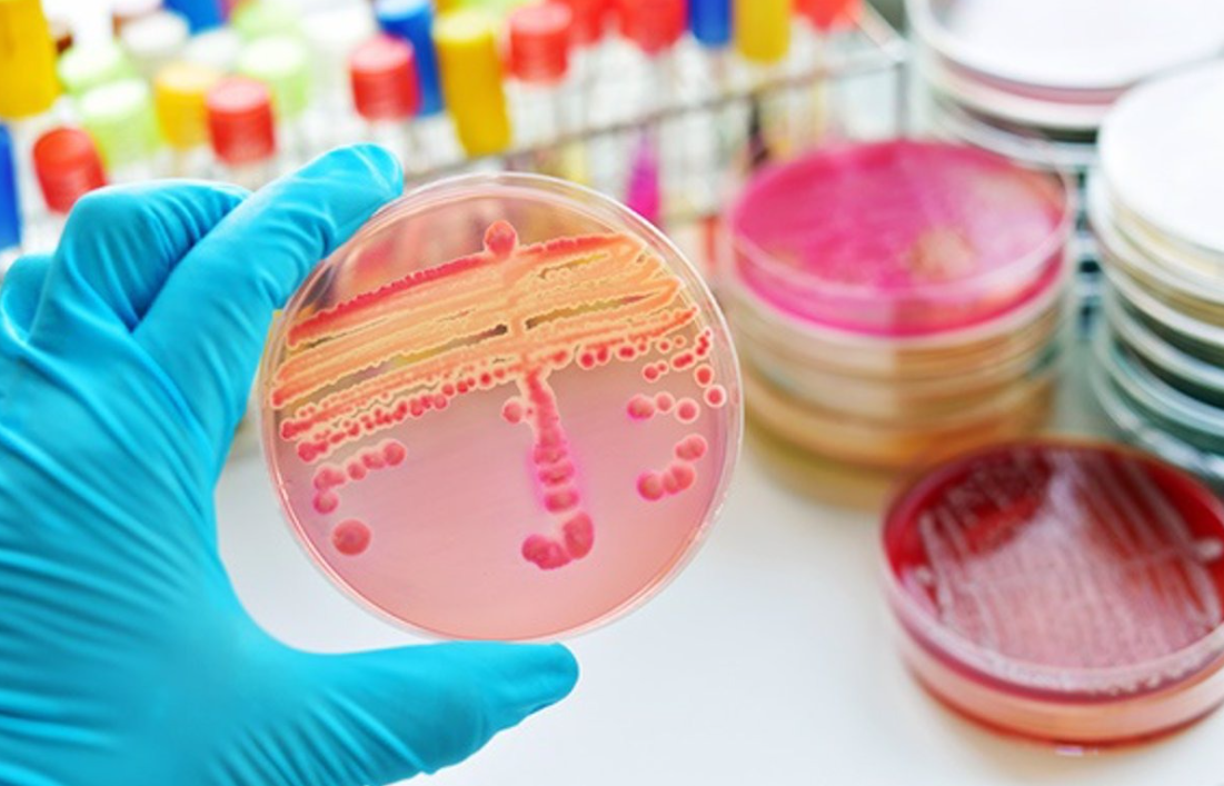CURSO DE ACTUALIZACIÓN Y ESTANDARIZACIÓN EN MICROBIOLOGIA CLÍNICA HNCASE