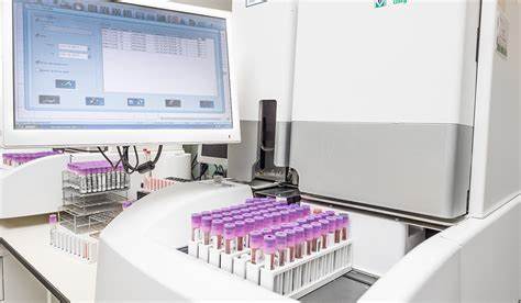 Estandarización y Aseguramiento de la Calidad en Pruebas Manuales de Hematología