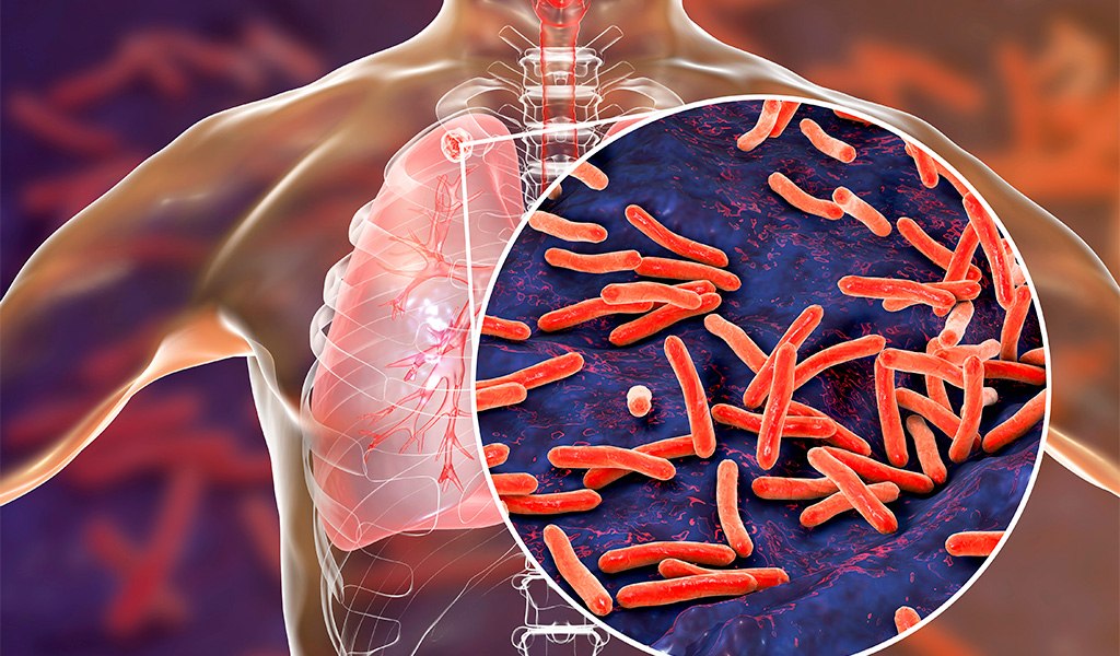 PROCESAMIENTO DE ESTUDIOS MOLECULARES PARA MYCOBACTERIUM TUBERCULOSIS
